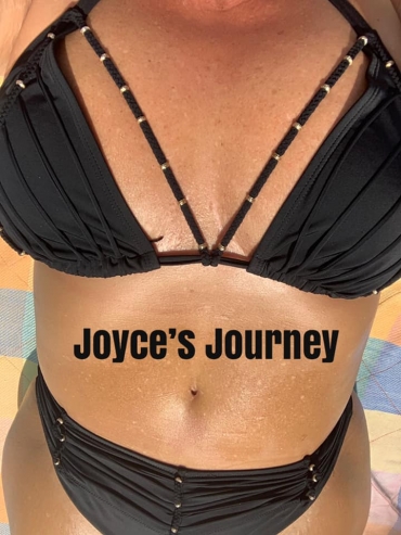 Joyce Weight Loss and Plastic Surgeries Journey
